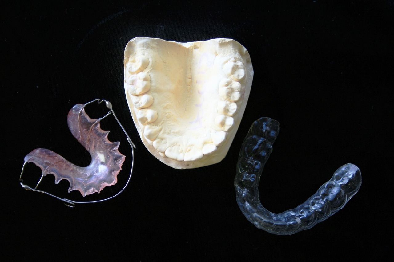 Immediate Loading: Accelerating Functional Restoration in Dental Implants